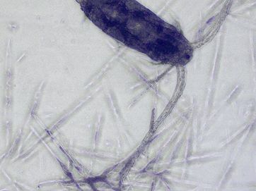 Microscopic image