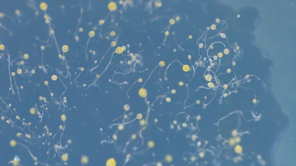 Mikroskopische Aufnahme der Fruchtkörper von D. discoideum auf einer Agarplatte