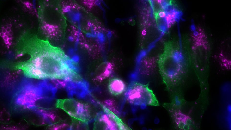 Fluoreszenzmikroskopisches Foto von Epithelzellen und Pilzsporen