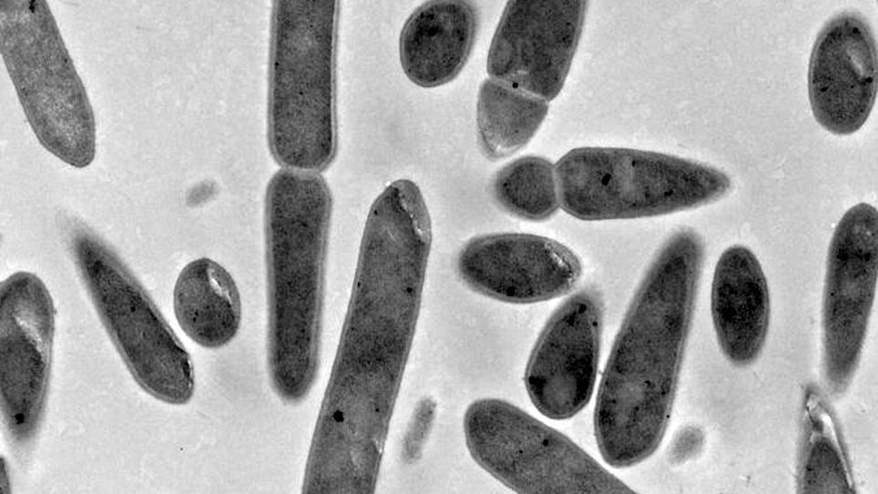 Das Bakterium Clostridium ljungdahlii unter dem Elektronenmikroskop. 