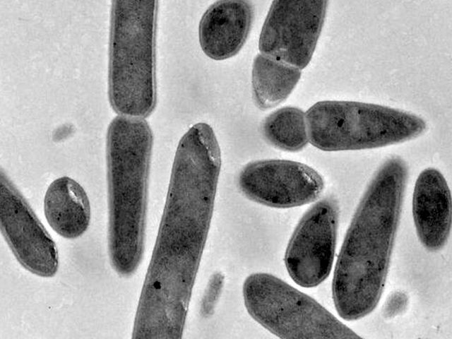 Das Bakterium Clostridium ljungdahlii unter dem Elektronenmikroskop. 