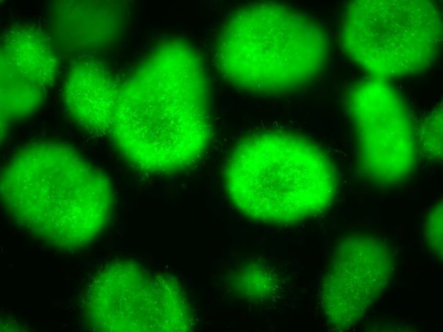 Grüne Flecken auf schwarzem Hintergrund: Der Schimmelpilz Aspergillus nidulans produziert ein grün fluoreszierendes Protein.