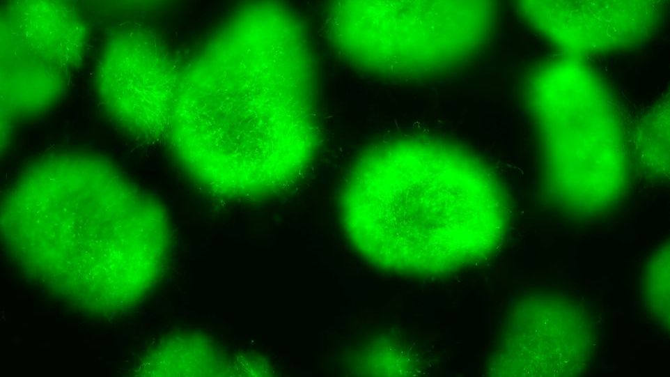 Dieser Aspergillus nidulans-Reporterstamm produziert grün fluoreszierendes Protein (GFP), wenn ein bestimmtes Gencluster aktiviert wird. Das wiederum passiert, wenn ein Arginoketid zugegeben wird. Grüne Flecken auf schwarzem Hintergrund: Der Schimmelpilz Aspergillus nidulans produziert ein grün fluoreszierendes Protein.