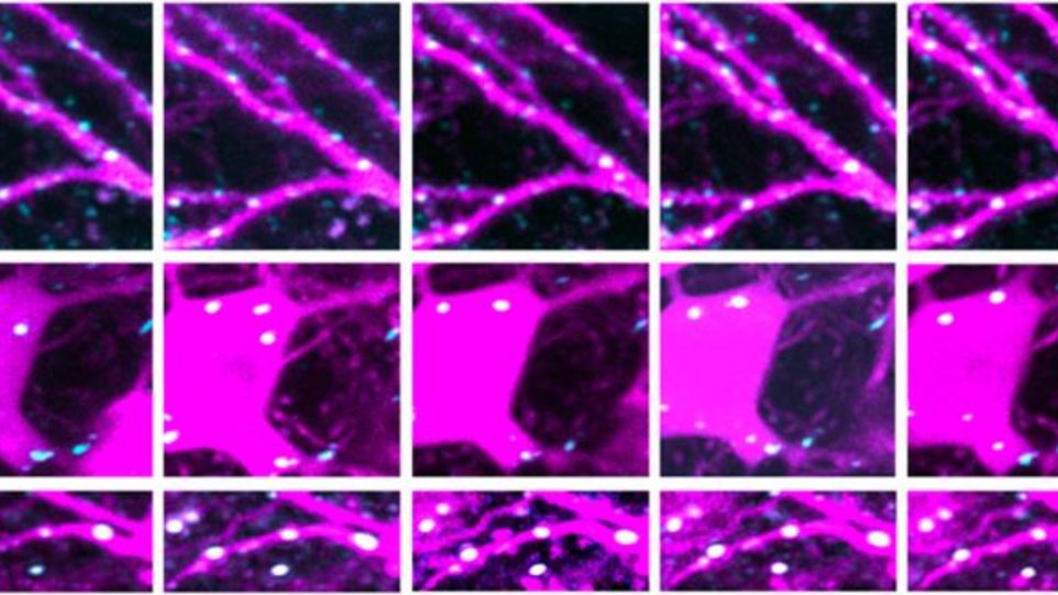 Zeitreihen aus dem Hippocampus lebender Mäuse: Während die Struktur der Nervenzellen stabil bleibt, verändern sich die hemmenden synaptischen Kontaktstellen im Zeitverlauf je nach Bereich der Nervenzelle unterschiedlich stark.