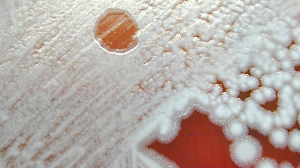 Auflösen von Bakterien durch Viren: Phagen bilden einen kreisrunden Lysehof in einer Bakterienkultur