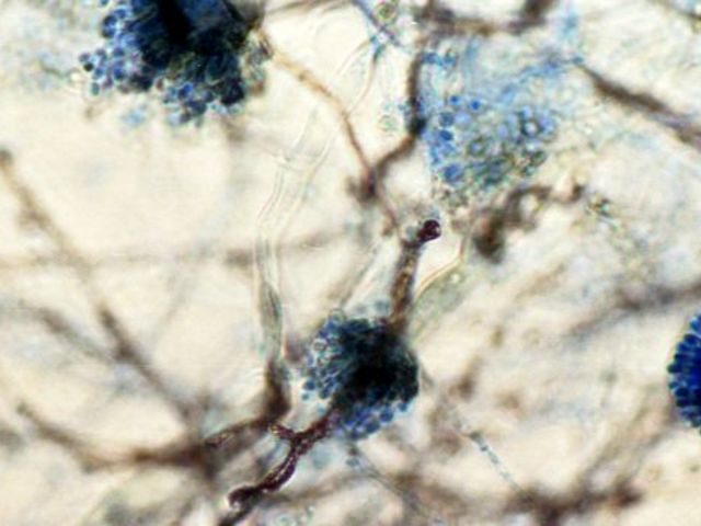 Das Bild zeigt die mikroskopische Aufnahme eines Schimmelpilzes.