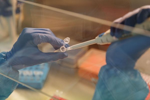 Prospect of diagnosis