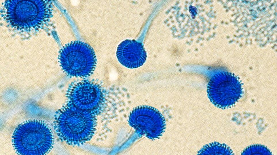 Aspergillus fumigatus A. fumigatus unter dem Mikroskop
