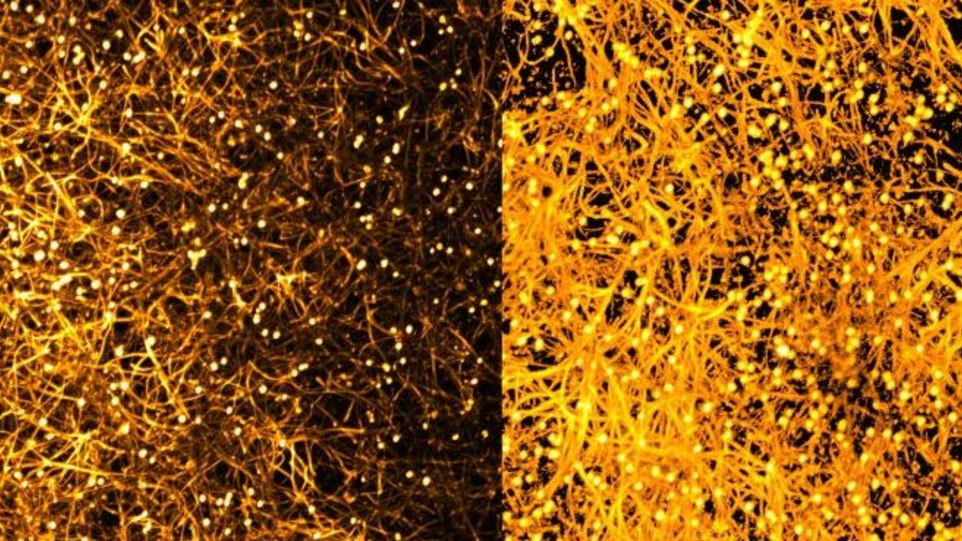 Albumin löst Pilzvirulenz aus: Candida albicans bildet in Gegenwart von menschlichem Albumin (rechts) dichtere Biofilme als in dessen Abwesenheit (links), und offenbart damit einen bisher versteckten Pathogenitätsweg Mikroskopische Aufnahme des Biofilms eines Pilzes