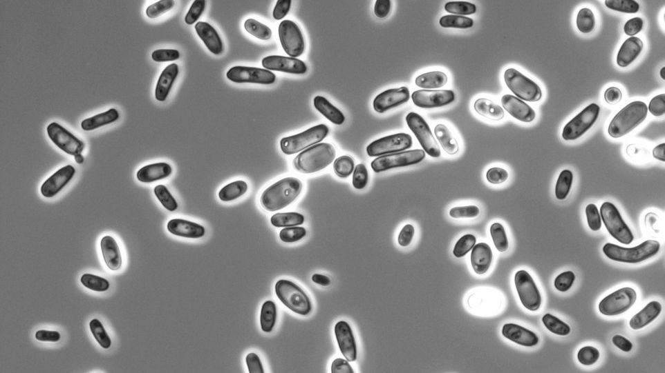 Mikroskopaufnahme von Candida tropicalis Hefezellen