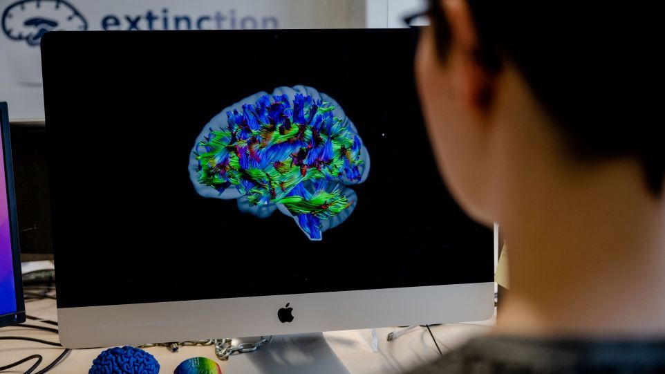 Wissenschaftlerin vor Computer-Bildschirm, auf dem verschiedenfarbig gekennzeichnete Gehirnregionen zu sehen sind
