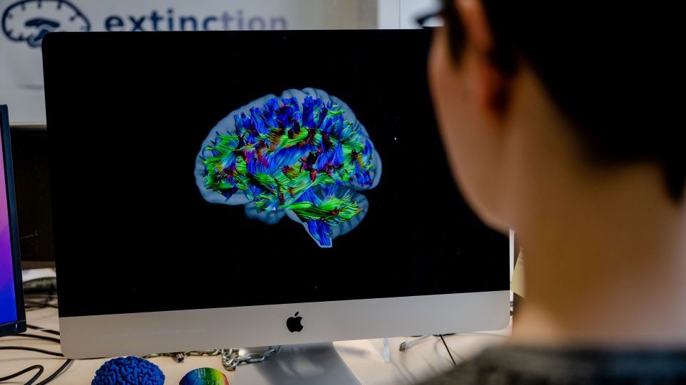 For the first time, researchers have studied all three parameters – genes, different brain characteristics and behaviour – simultaneously. Scientist in front of a computer screen showing brain regions marked in different colors.