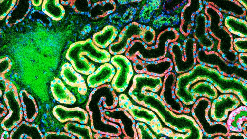 Gallensäure zerstört die Epithelzellen der Niere. Die Hemmung des dafür verantwortlichen Transportproteins soll den Zelltod verhindern. Mikroskopaufnahme