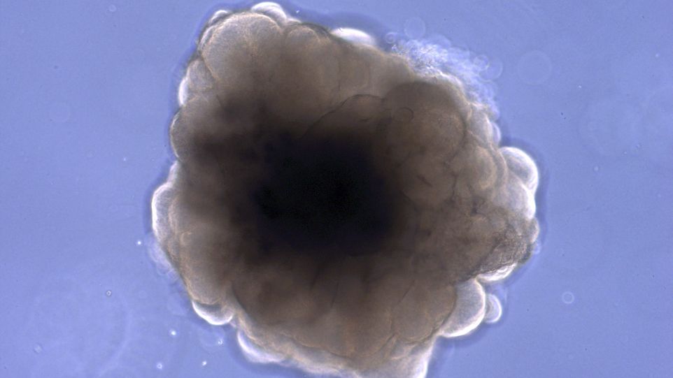 Brain organoid of a rhesus macaque.
