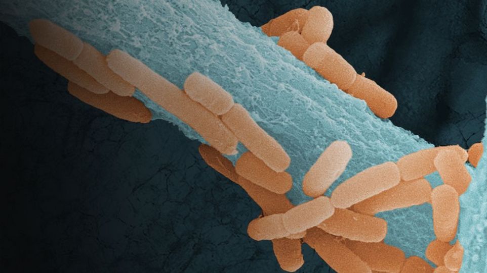 Ligilactobacillus murinus (orange), Bestandteil des Lungenmikrobioms der Maus, entlang der Hyphen des lungenpathogenen Pilzes Aspergillus fumigatus (blau), mit Lungengewebe im Hintergrund Orange "Stäbchen" des Lungenmikrobioms wuchern auf einem blauen Stamm des Pilzes, Lungengewebe im Hintergrund