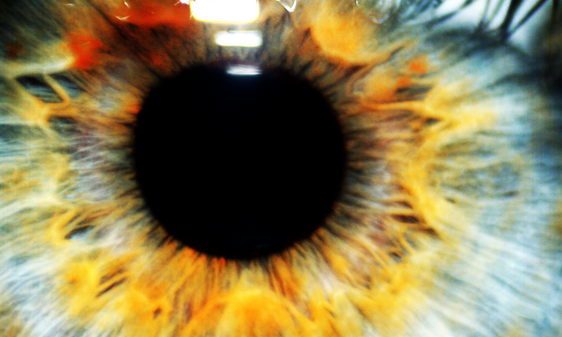 Bild von einem Auge