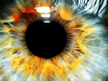 Bild von einem Auge Bild von einem Auge