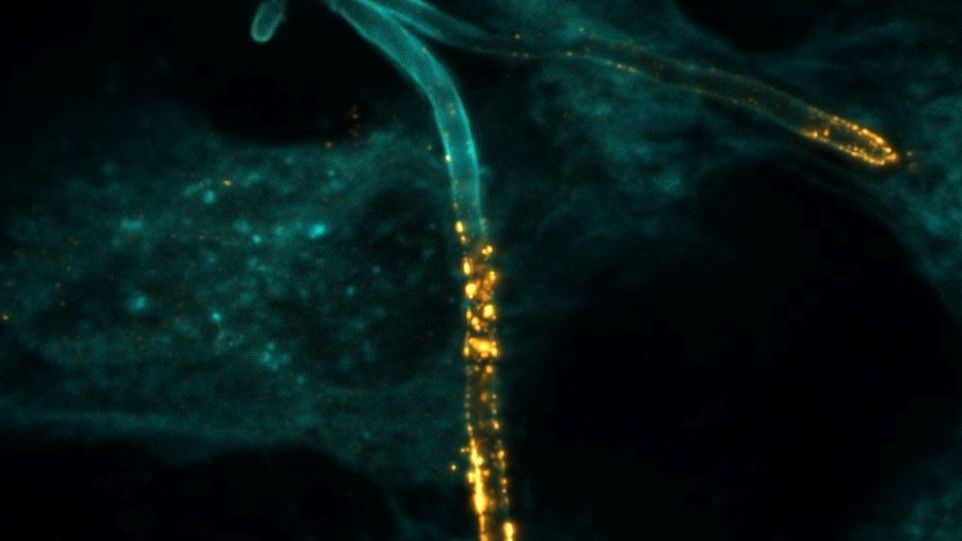 Mikroskopaufnahme des Pilzes Candida albicans