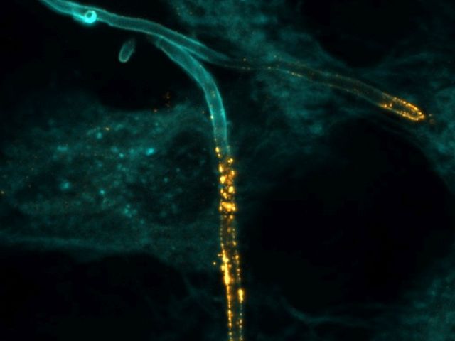 Mikroskopaufnahme des Pilzes Candida albicans