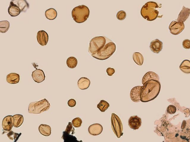 Pollenkörner unter dem Mikroskop