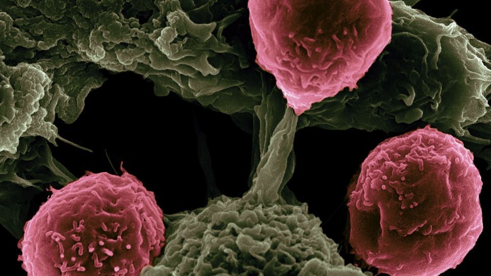 Unter dem Rasterelektronenmikroskop: Dendritische Zellen interagieren mit T-Zellen