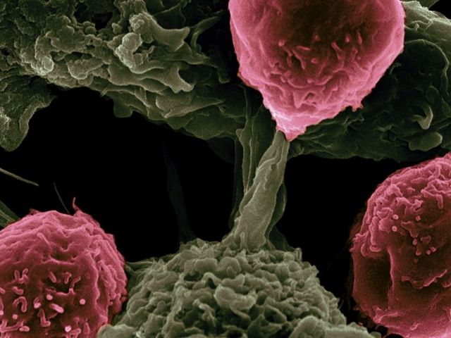 Unter dem Rasterelektronenmikroskop: Dendritische Zellen interagieren mit T-Zellen