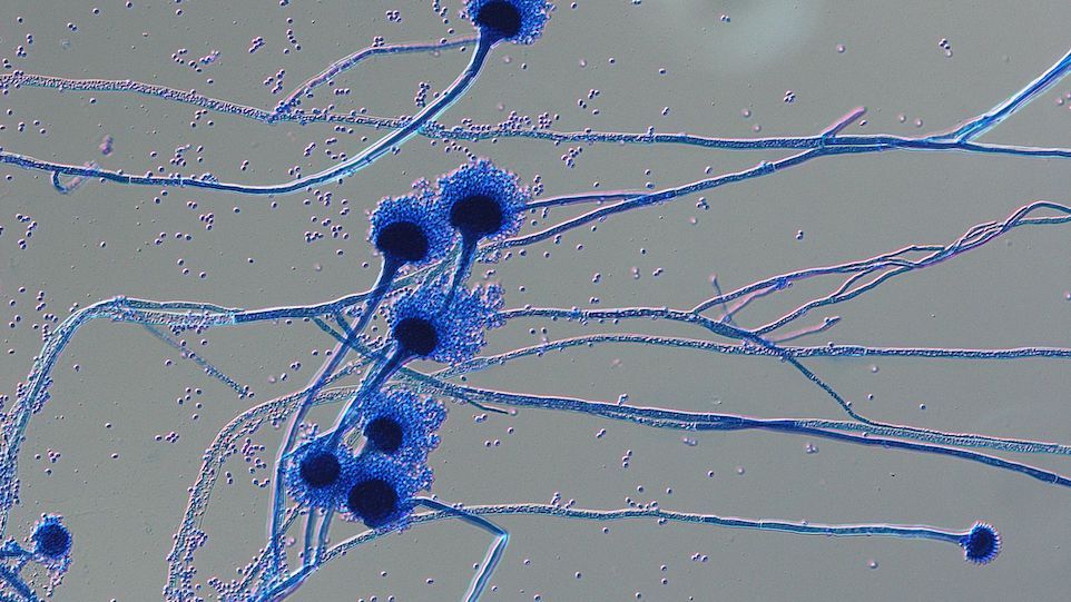 Mikroskopische Aufnahme von Sporenträgern des Pilzes Aspergillus fumigatus