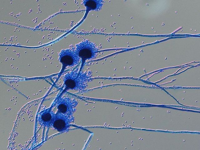 Mikroskopische Aufnahme von Sporenträgern des Pilzes Aspergillus fumigatus