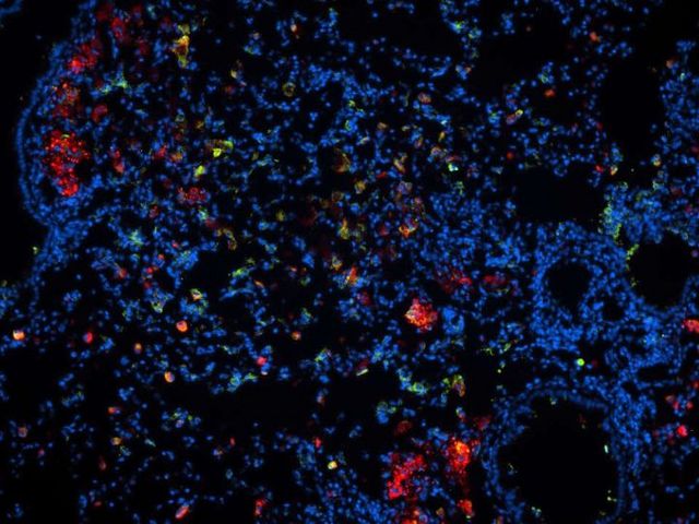 Rote und blaue mikroskopische Strukturen auf schwarzem Hintergrund.
