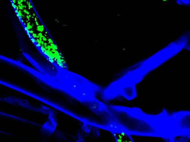Grün und blau fluoriszierende Bakterien und Pilzfäden auf schwarzem Hintergrund.