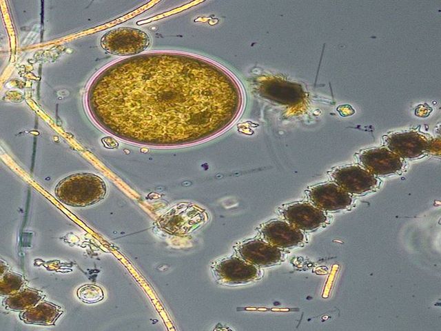 Mikroskopische Aufnahme von Kleinstlebewesen der Ostsee