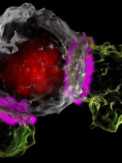 Zwei CAR-T-Zellen greifen ine Tumorzelle an