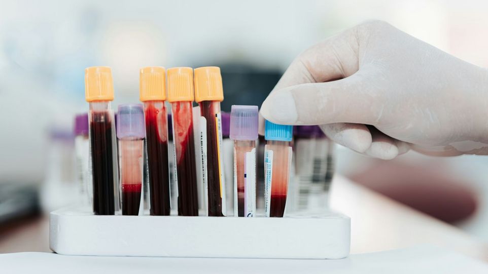 Test tubes with blood