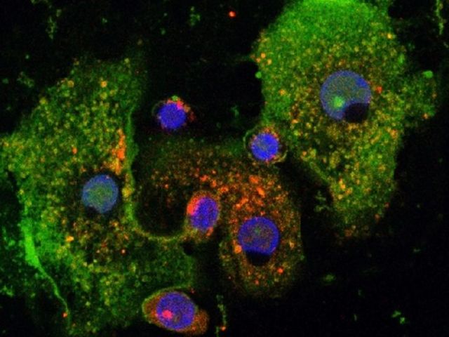 Human macrophages - with the immune-regulatory peptide Pep19-2.5 (green) and staining of ‚dispersed transgolgi network membranes‘ (red).