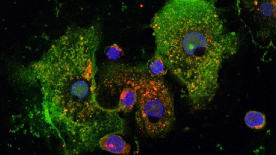 Human macrophages - with the immune-regulatory peptide Pep19-2.5 (green) and staining of ‚dispersed transgolgi network membranes‘ (red).