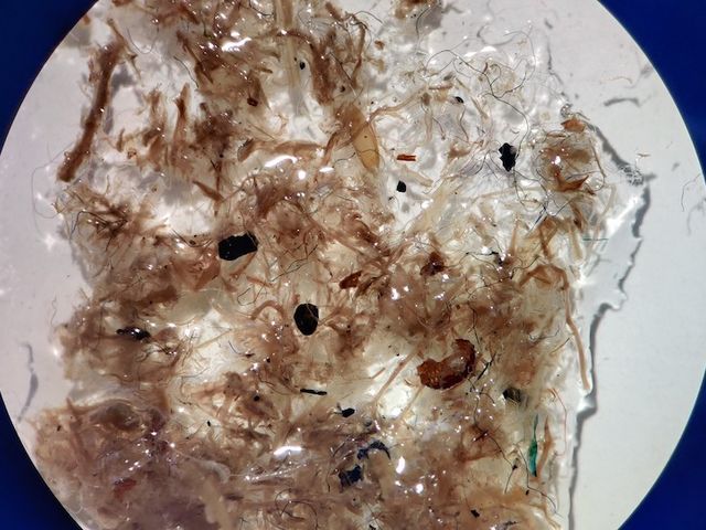 Close-up of sewage sludge