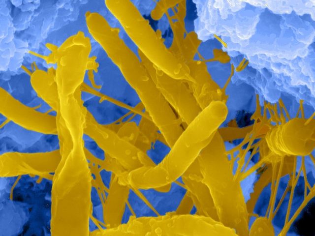 Mikroorganismen (Bakterien) auf natürlichem Zeolith