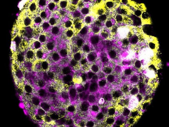daLUXendins can be visualized using fluorescence microscopy to pinpoint GLP1R and GIPR binding and activation.