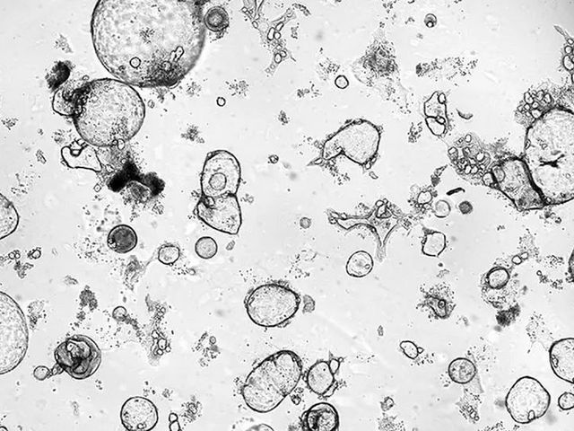 Released factors from activated killer T cells promote the growth of human mini-organs (organoids). Cells